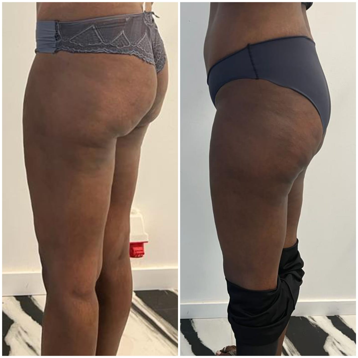 93bda1ca-4c0d-48ac-ab84-2ec18da6bd27