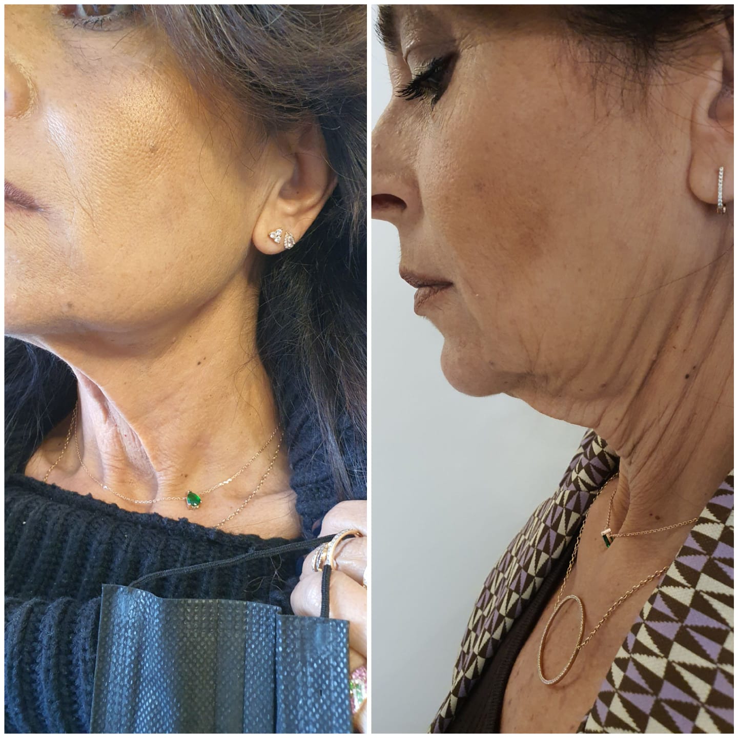 c18c49c4-cdb2-45ba-9123-dfc9b9a22d7a