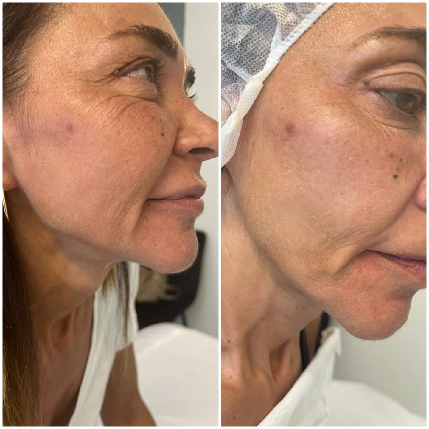 fe9d5111-2679-4d07-b32f-6bc52d472784